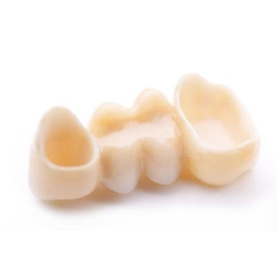 Dental Crowns Dental Crowns