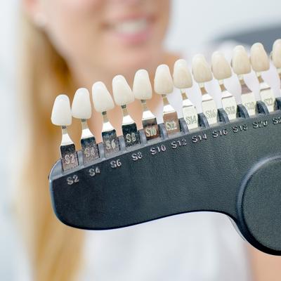 Dental Veneers Dental Veneers