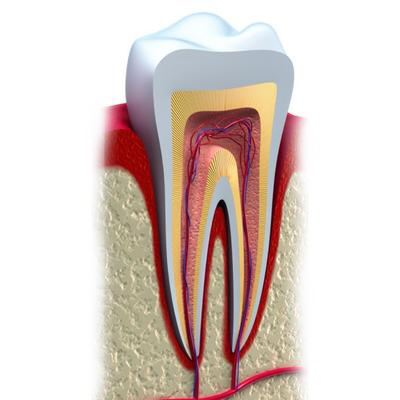 Root Canal Root Canal